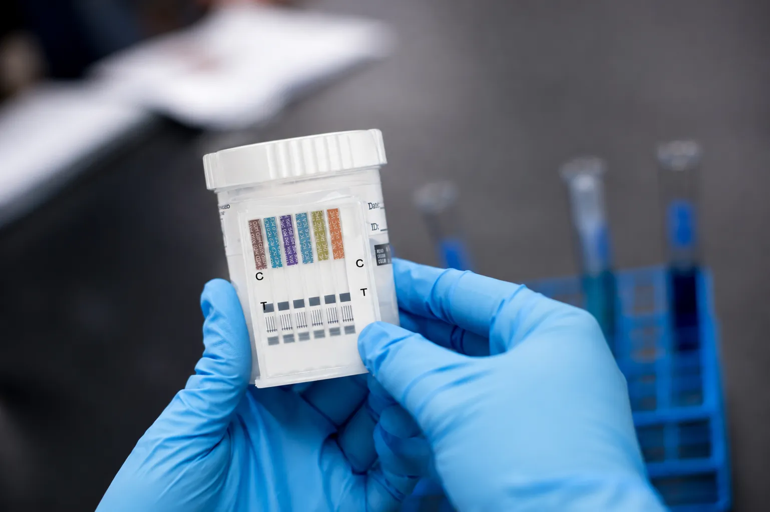 Técnica con guantes sosteniendo una copa de prueba de drogas en orina con tiras de colores